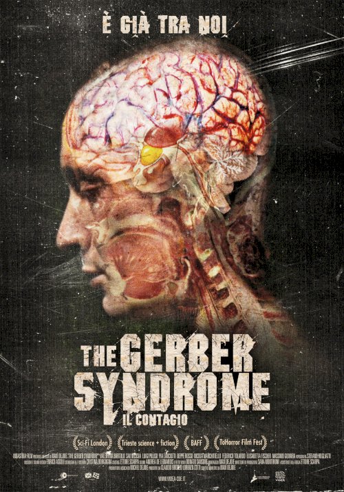 The Gerber Syndrome - Il contagio - Movie Poster The Gerber Syndrome - Il contagio - Movie Poster