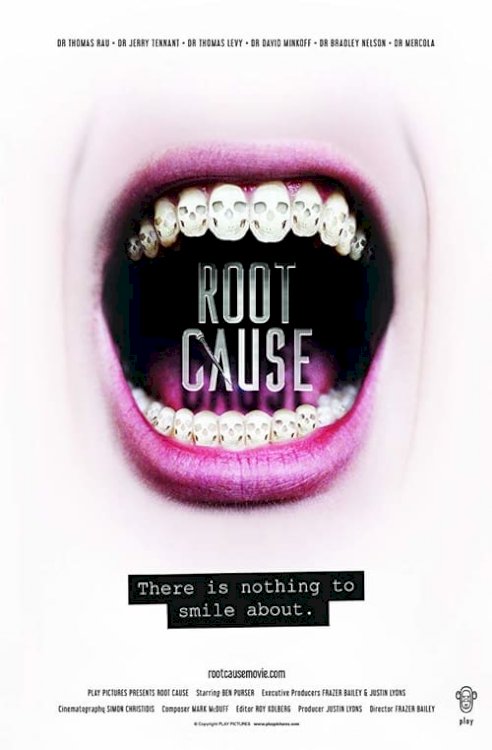 Root Cause - Movie Poster Root Cause - Movie Poster