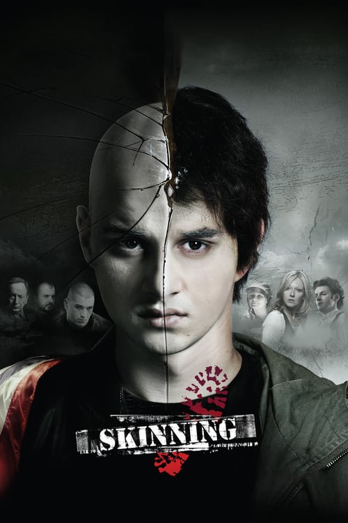Skinning - Movie Poster