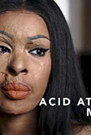 Acid Attack: My Story - Movie Poster