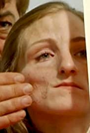 The Girl with Half a Face